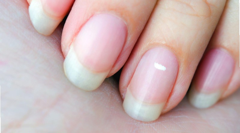 Nails