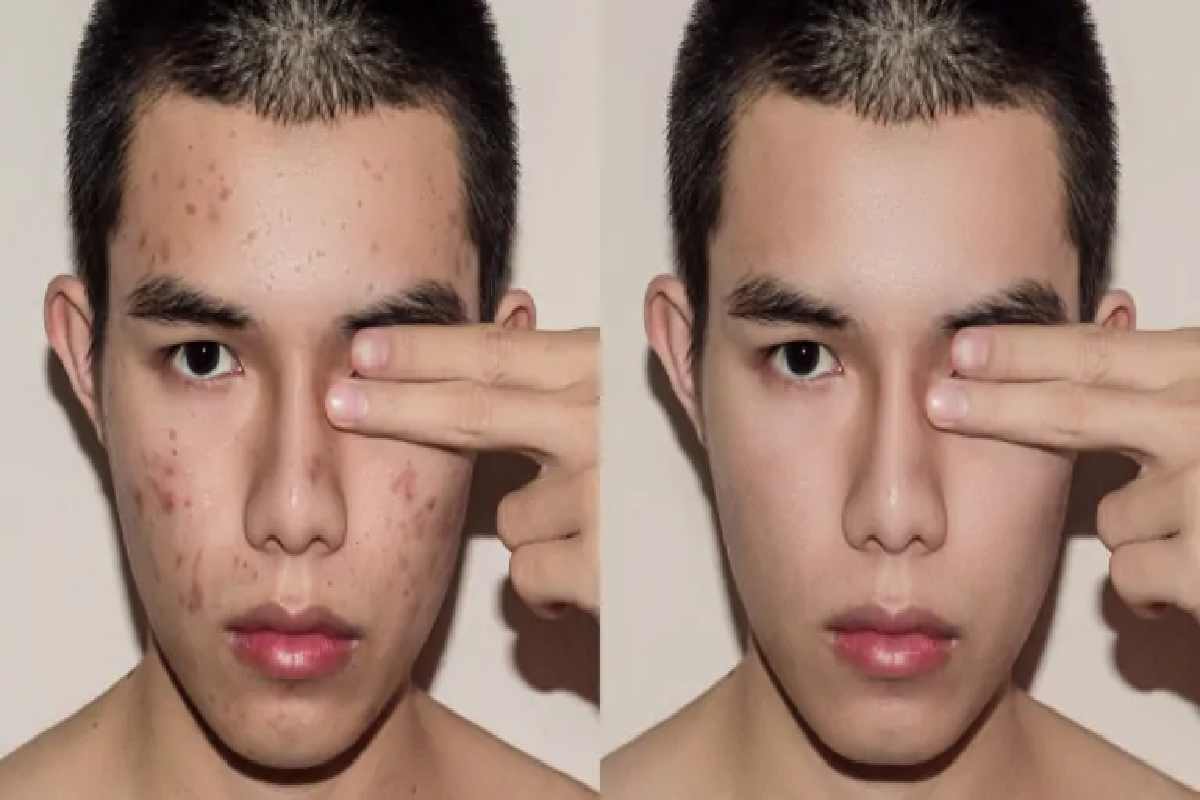 Image default